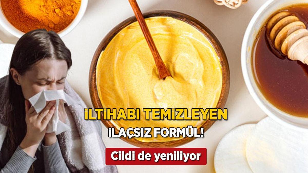vucuttaki iltihabi sifirlayan ilacsiz formul yogurtla karistirin cildi de yeniliyor lDNJRyGL.jpg