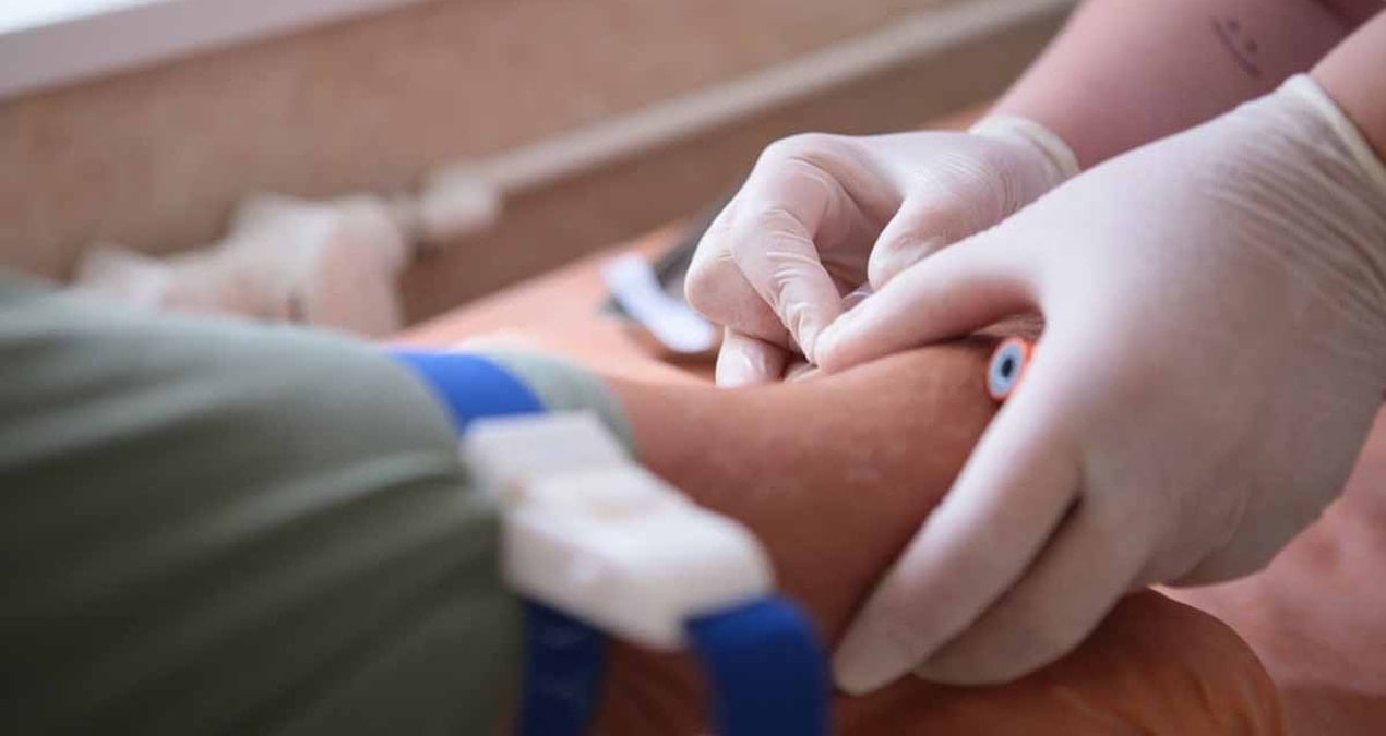 40 yasindan sonra herkesin yaptirmasi gereken 3 kan testi H1iJC9za.jpg